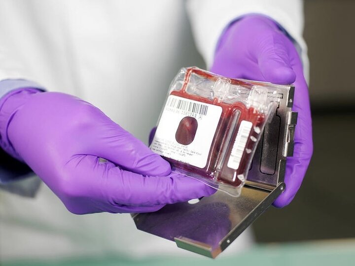 ذخیره سازی ۱۵۰۰ نمونه خون بندناف در جنگ رمضان