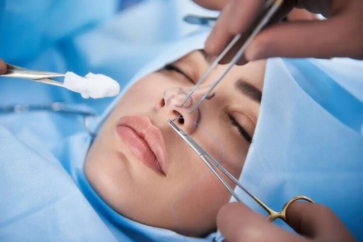 رشد عملهای زیبایی در شیراز؛ ضرورت پایش روانی پیش از تصمیم به جراحی